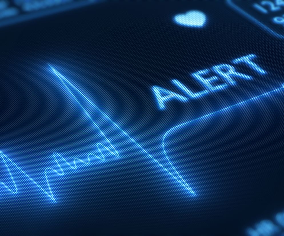 Asystolia: przyczyny, objawy, leczenie