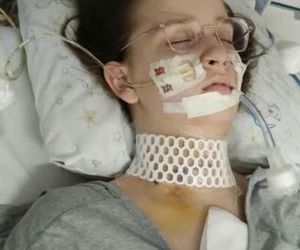 Koń zrujnował życie 16-letniej Klaudii. Mama: Cudem udało się ją uratować