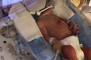 Czworaczki z Poznania