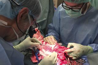 PIERWSZY TEGO TYPU PRZESZCZEP.