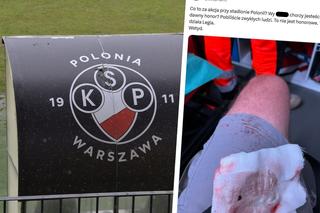 Kibice Polonii Warszawa pobici pod stadionem przez kiboli Legii. To chore