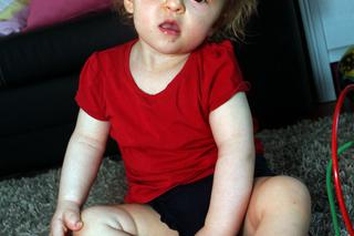 Moja syrenka odzyskała paluszki