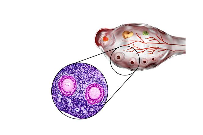Rezerwa jajnikowa – twoja pula komórek jajowych