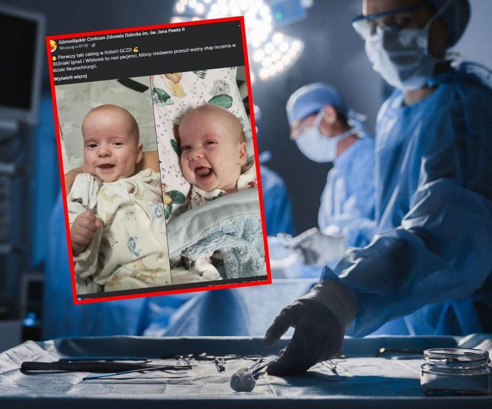 Niezwykła operacja w GCZD w Katowicach. Piękna historia
