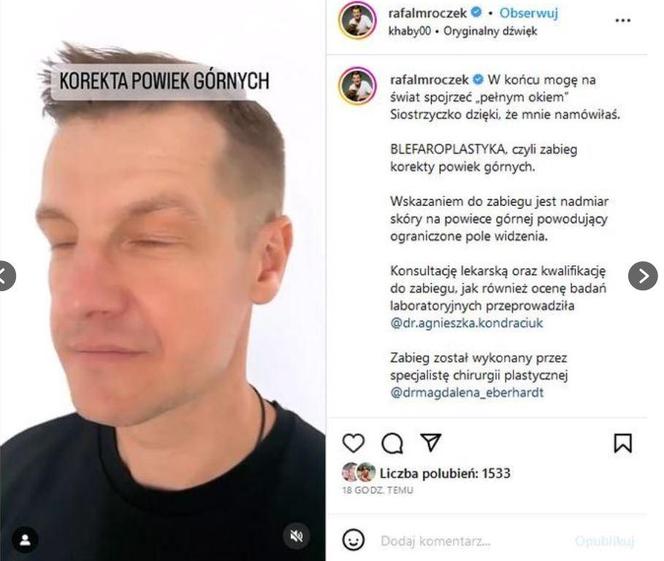 Gwiazdy wycięły sobie powieki