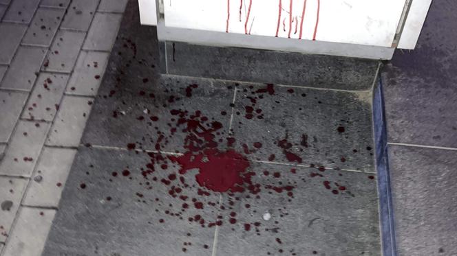 Horror na Woli. Kobieta w szale wysmarowała swoją krwią samochody