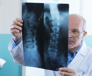 Operacje kręgosłupa  - nowe metody leczenia