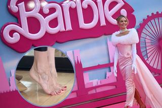 Barbie foot challenge niebezpieczny dla zdrowia? 