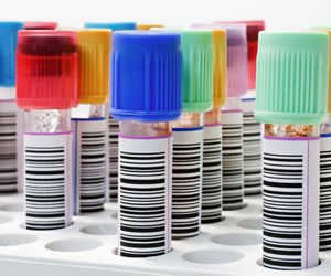 Toksoplazmoza: objawy i leczenie