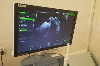 Nowoczesny sprzęt w czeladzkim szpitalu