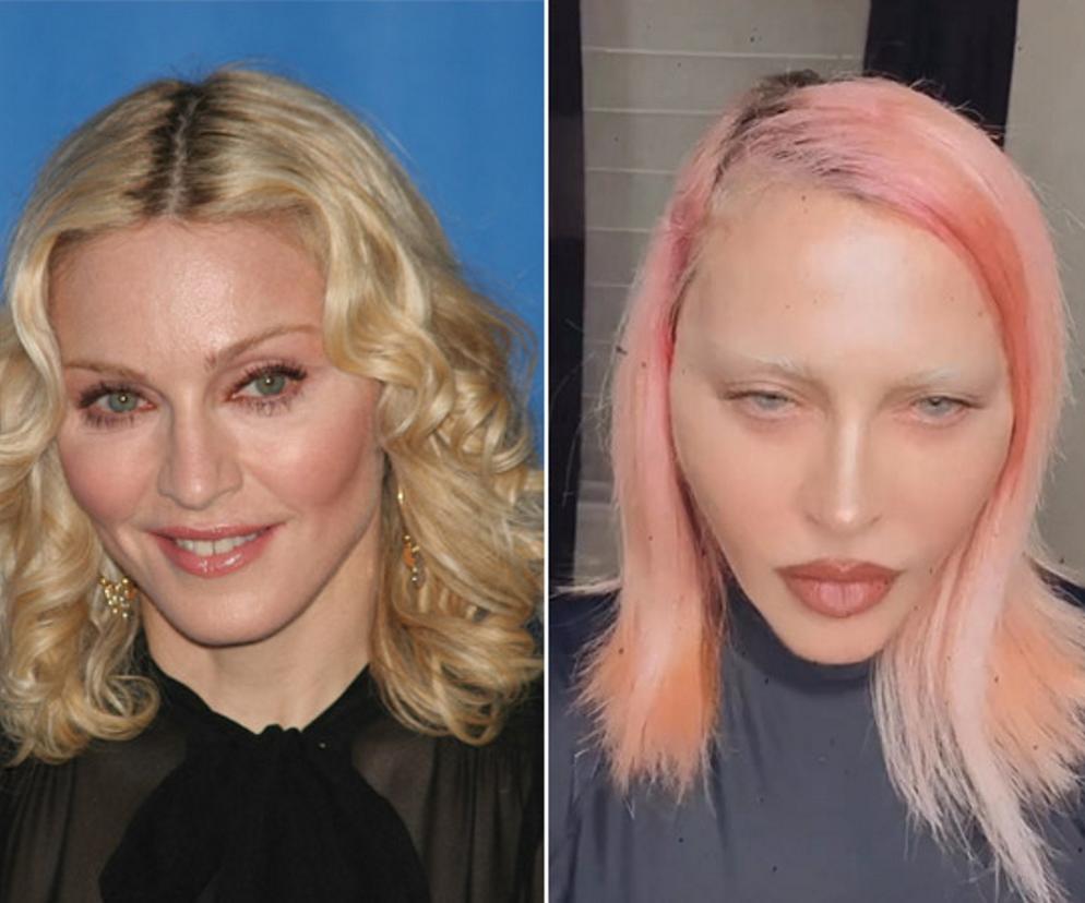  Madonna ma nową twarz! Nie sposób jej poznać. Chirurg ujawnia, co zrobiła