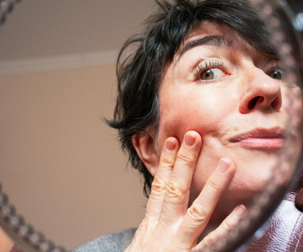 Jak schudnąć z twarzy? 6 skutecznych metod na wyszczuplenie owalu