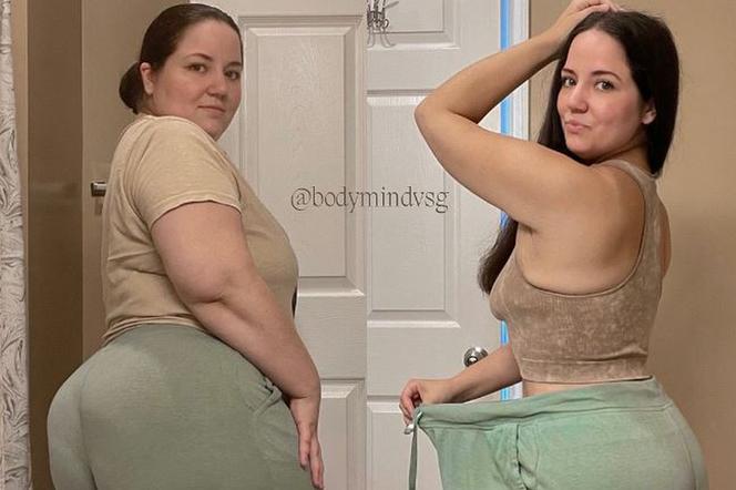 25-latka dzięki operacji bariatrycznej schudła ponad 60 kilogramów  
