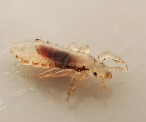 Wszawica - jak pozbyć się wszy? Zwalczanie wszy