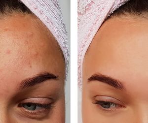 Spłyca zmarszczki i pozbywa się pryszczy. Przepis na ten prosty tonik ma 1000 lat