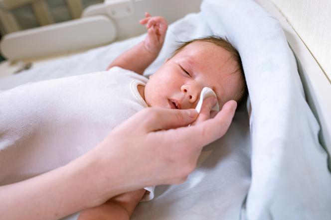 Jak wyjąć rzęsę z oka noworodka?