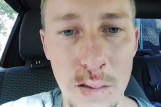 Wypił dwie butelki zimnej wody w czasie upału. O mało nie przypłacił tego życiem