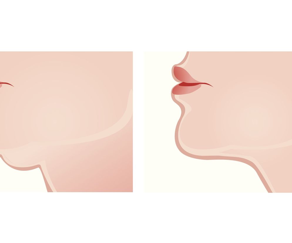 Regularne wykonywanie ćwiczeń mięśni twarzy pomoże ci pozbyć się drugiego podbródka.