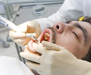 Choroby przyzębia - objawy, przyczyny, leczenie