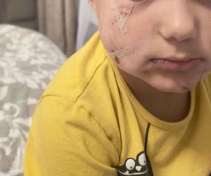 Pogryziony Franek potrzebuje pomocy. Policja szuka właściciela psa. Do szpitala dotarła anonimowa wiadomość