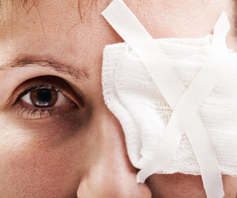 Oko po prostu pękło, nie było co zbierać. Konsekwencje zbyt długich paznokci?