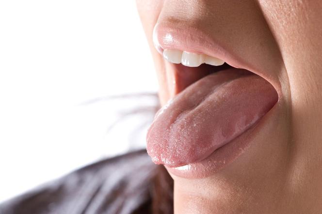 Problemy z tarczycą widoczne są w… jamie ustnej