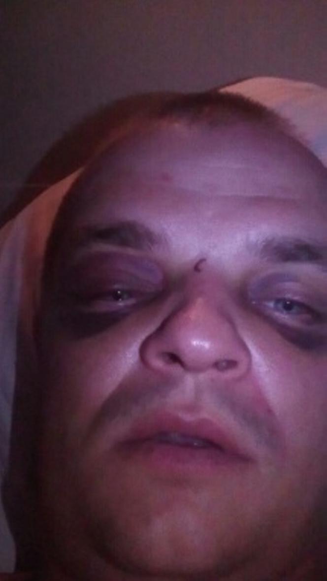 Pobili mnie sołtys i jego brat 