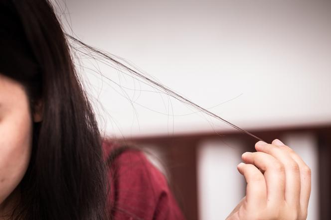 Jak leczyć niekontrolowane wyrywanie włosów?