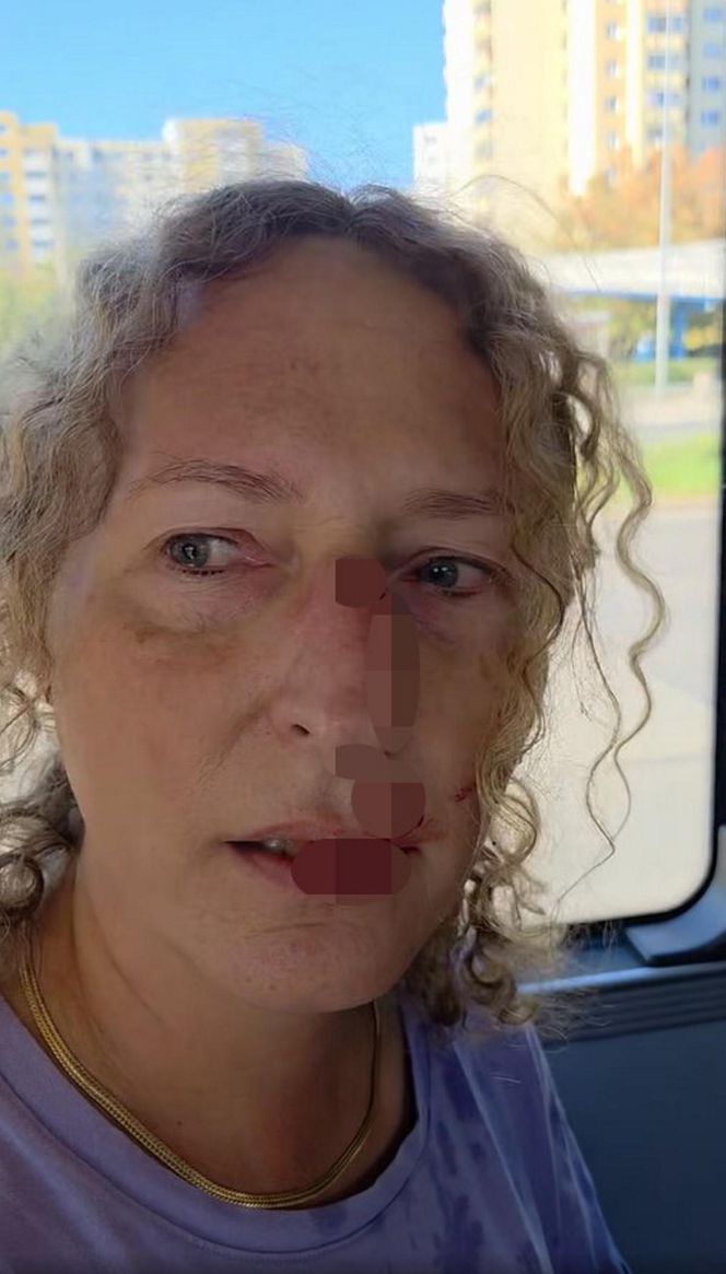 Zenobia broniła Ukrainki w autobusie w Warszawie. Została zaatakowana. „Krew polała się z nosa”