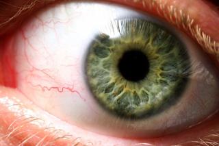 Przeszczep rogówki - jak przebiega przeszczep rogówki w oku?