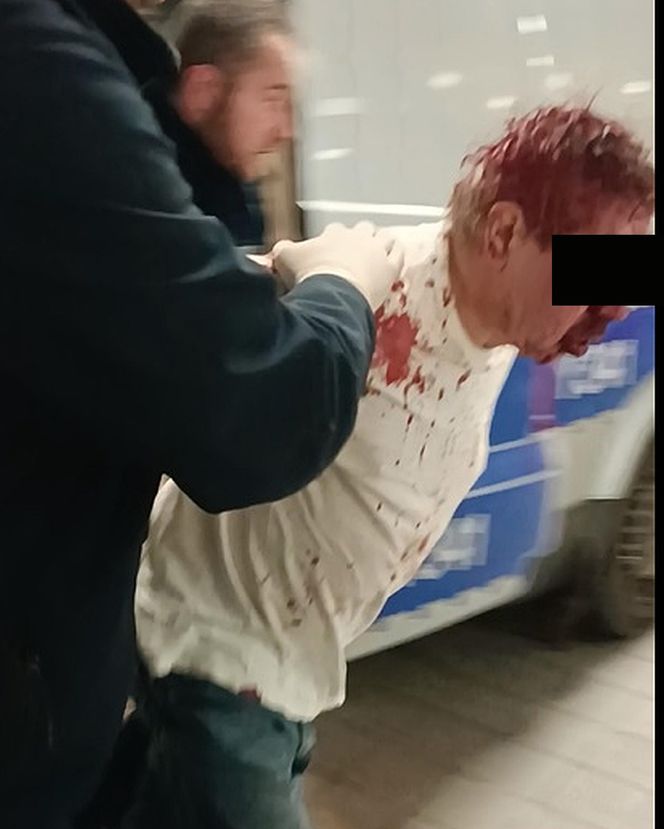 Przedłużony areszt dla zbójcy ratownika