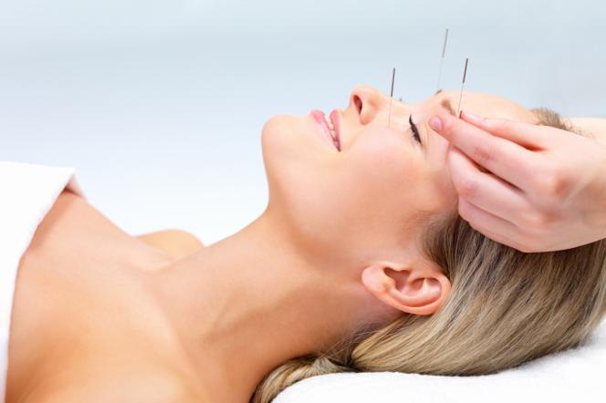 Akupunktura odmładza. Sprawdź zalety akupunktury kosmetycznej