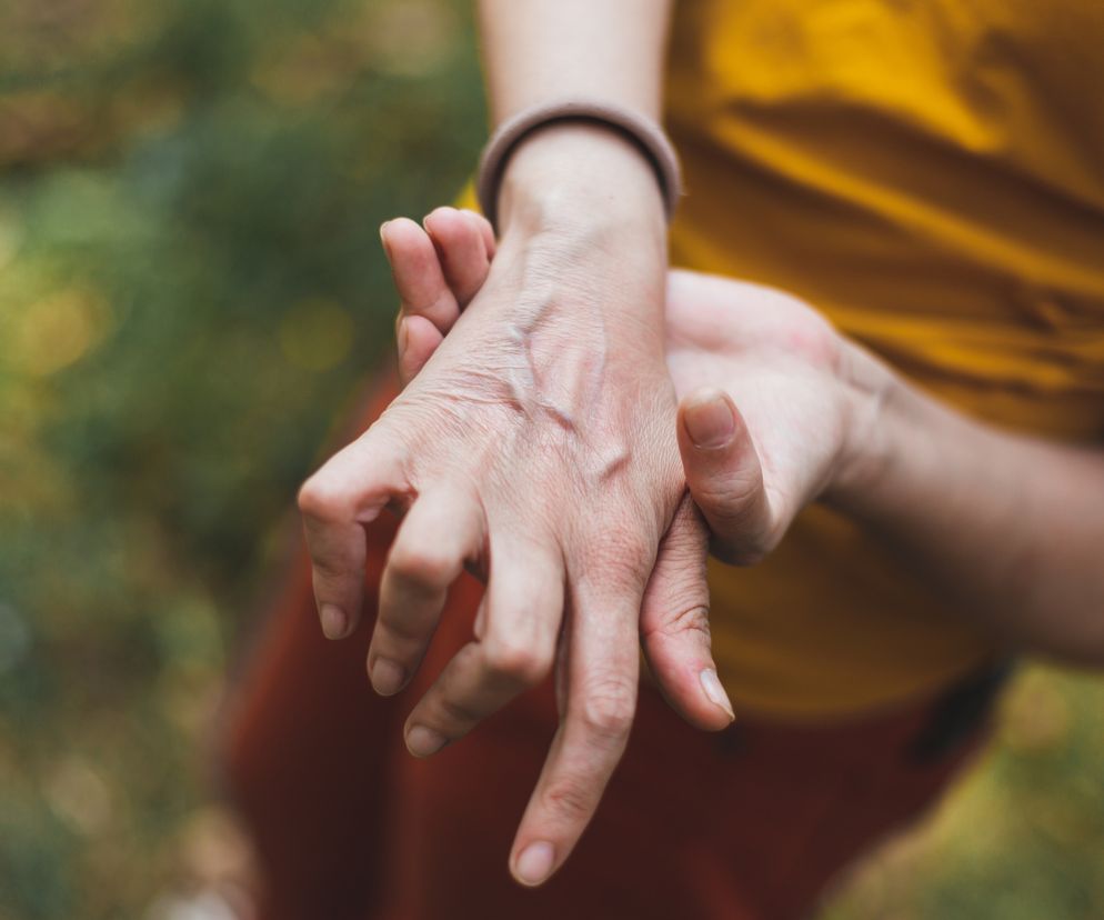 Kobieta trzyma się za bolącą dłoń