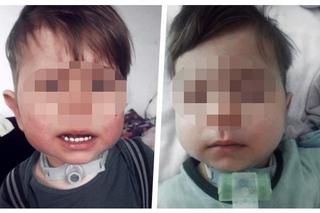 Mały Wiktorek pilnie potrzebuje ratunku! Trzeba mu pomóc całym sercem, bo ma tylko pół serduszka [ZDJĘCIA].