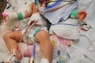 Natanek potrzebuje pomocy