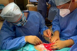 Operacja pacjentki z nowotworem oczodołu