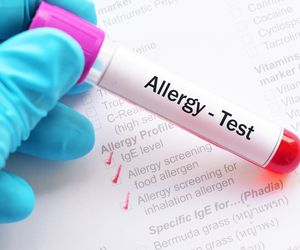 Test RAST (test radioalergoseparacji): kiedy go wykonać? Jak przebiega?