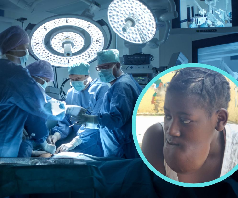 Niezwykła operacja lekarzy z Olsztyna. 15-latka z Angoli dostała szansę na nowe życie