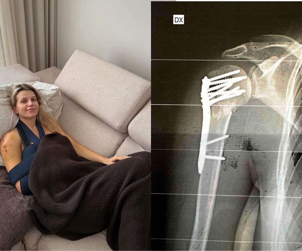 Znana dziennikarka walczy o zdrowie. Ból, który w skali od 1 do 10 oceniam na 15