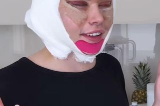 Julia Von Stein po operacji 
