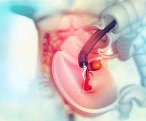Polipektomia czyli zabieg usunięcia polipów. Wskazania, przygotowanie, przebieg
