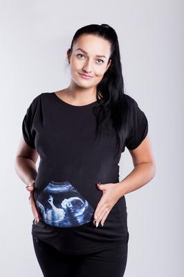 Bluzka ciążowa z nadrukiem 2