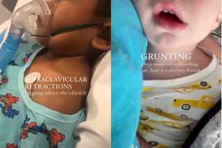 Nieprawidłowy oddech u dziecka. Pediatra alarmuje: w tych sytuacjach od razu jechać do szpitala