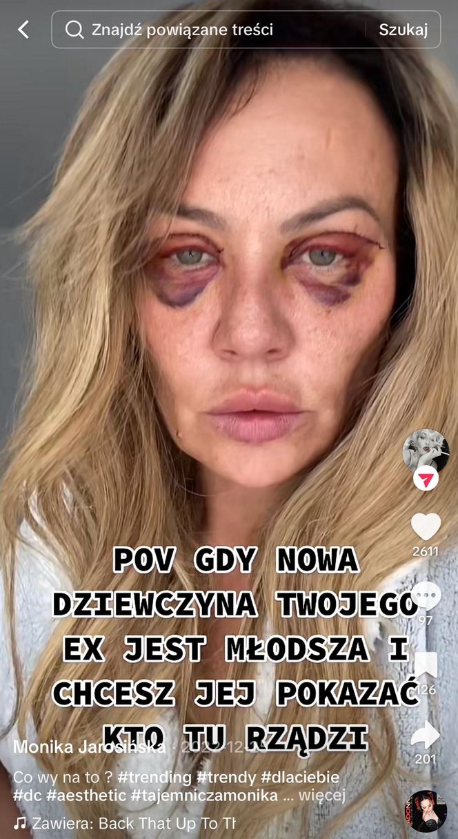 Jenningsowie kontra Alzheimer (BBC Earth)