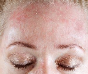 Tak rozpoznasz, że jesz za dużo słodyczy. Czym jest cera cukrowa?