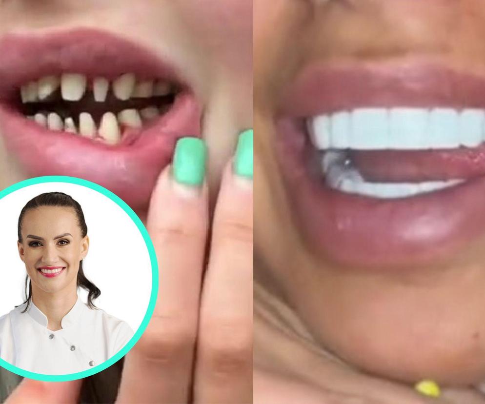 Tureckie zęby to koszmar polskich stomatologów 