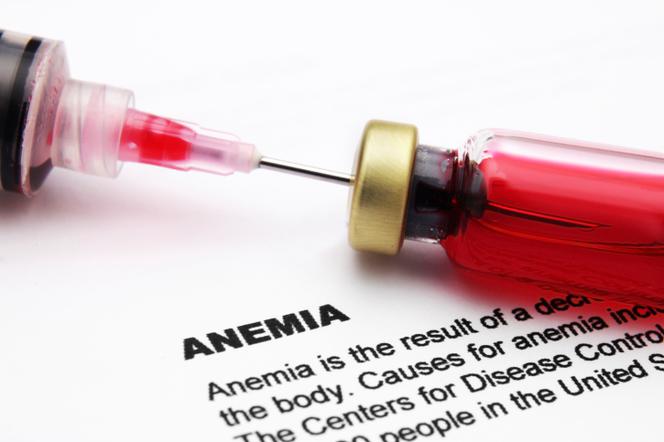 Niedokrwistość Anemia Złośliwa Przyczyny I Objawy Choroba Addisona 5175