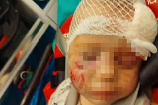 Pies pogryzł 3-latka na przystanku