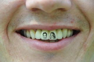 Portret Amy Winehouse na zębie, czyli jak powstają dentotatuaże