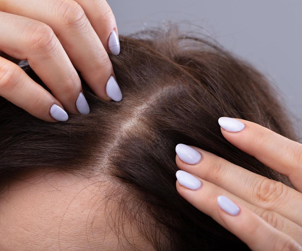 Wmasuj w skórę głowy raz w tygodniu. Wysyp nowych włosów gwarantowany